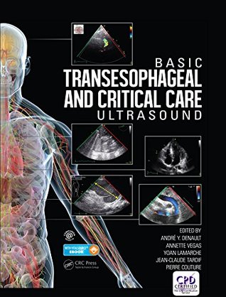 Full Download Basic Transesophageal and Critical Care Ultrasound - Andre Denault file in ePub
