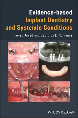 Full Download Evidence-Based Implant Dentistry and Systemic Conditions - Javed file in PDF